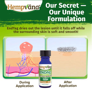 Hempvana End Tag Skin Tag Remover - As Seen on TV